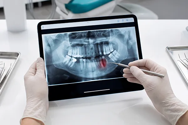 Especialistas en ortopedia maxilofacial en Puebla para desarrollo facial infantil y corrección ósea